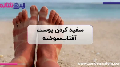 سفید کردن پوست آفتاب‌سوخته؛ ۷ روش مؤثر خانگی برای روشن کردن و ترمیم پوست