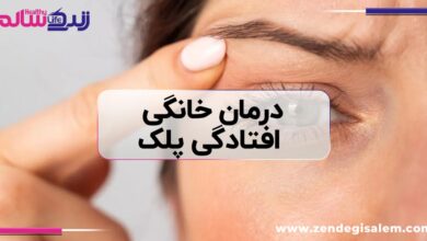 درمان خانگی افتادگی پلک