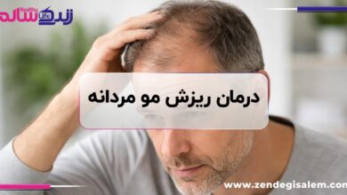 ریزش مو مردانه