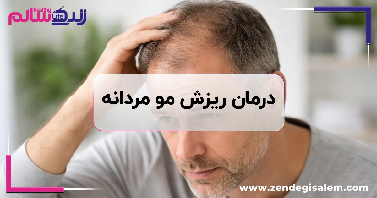 ریزش مو مردانه