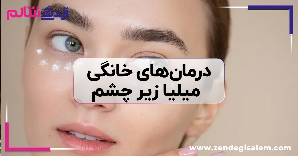 درمانهای خانگی میلیا زیر چشم