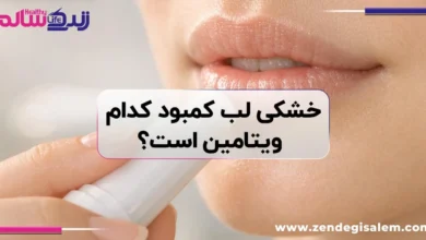 خشکی لب کمبود کدام ویتامین است؟ (راهنمای کامل + درمان‌های خانگی)