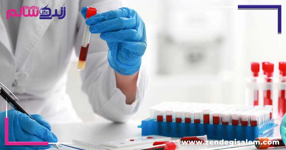 تفسیر نتیجه آزمایش خون