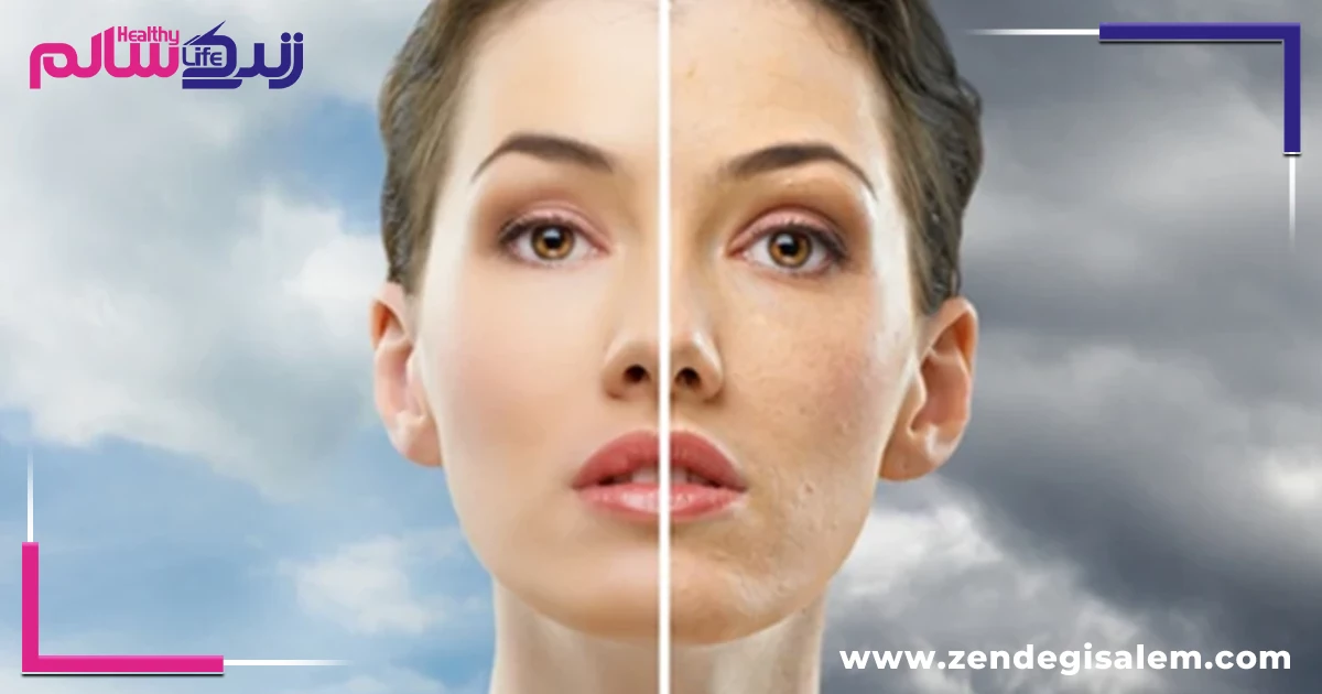 آلودگی هوا چگونه به پوست آسیب میزند؟