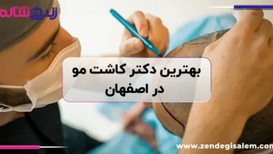 بهترین دکتر کاشت مو در اصفهان، معرفی بهترین کلینیک‌های کاشت مو اصفهان